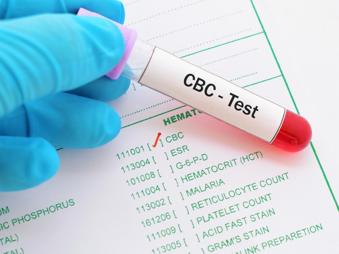 Blood sample tube labelled for a CBC test